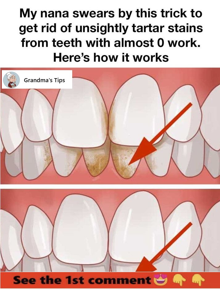 I love the first method!