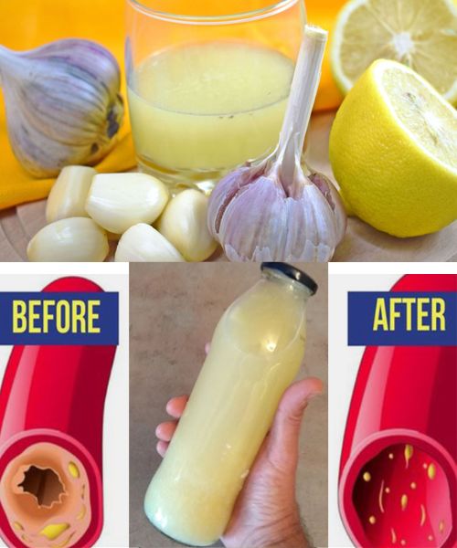 A Natural Elixir for Your Heart: Lemon, Garlic, and Water