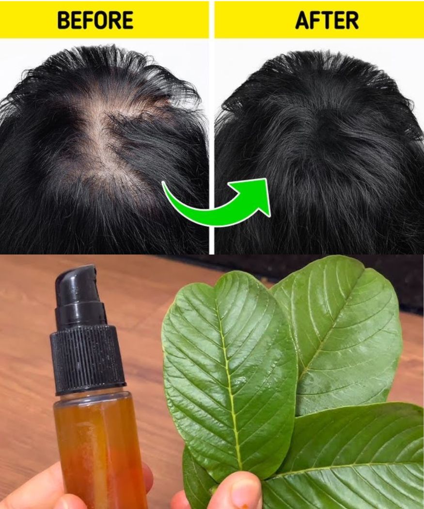 Put Guava Leaves in Your Shampoo and Watch Your Hair Grow Even on Your Forehead!