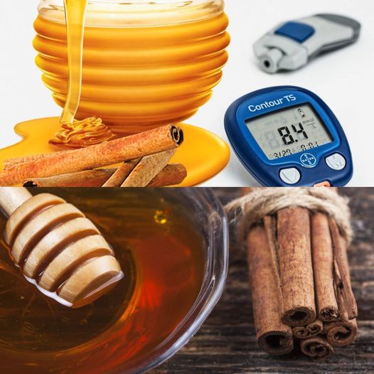 Ancient Recipes for Health: Lower Cholesterol, Reduce Sugar, Alleviate Painful Inflammation, and Boost Immunity with Honey and Cinnamon