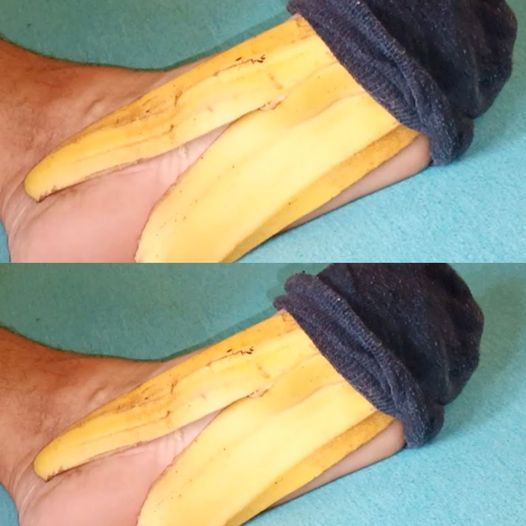 Think Twice Before Tossing Banana Peels: Hidden Uses and Benefits