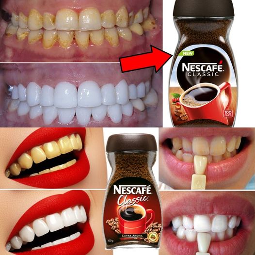 Brighten Your Smile at Home in Just Two Minutes: A Natural Teeth Whitening Guide