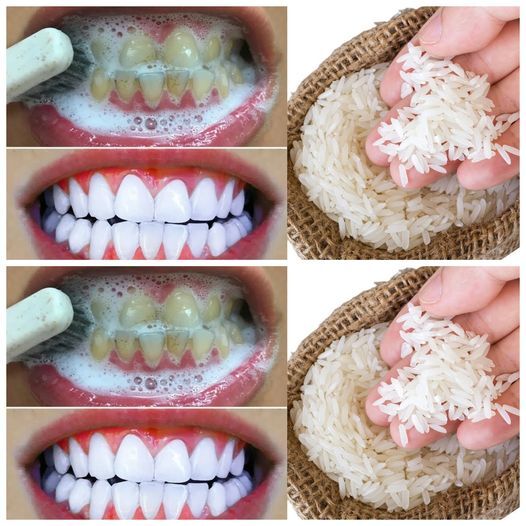 1-Minute Teeth Whitening Magic!