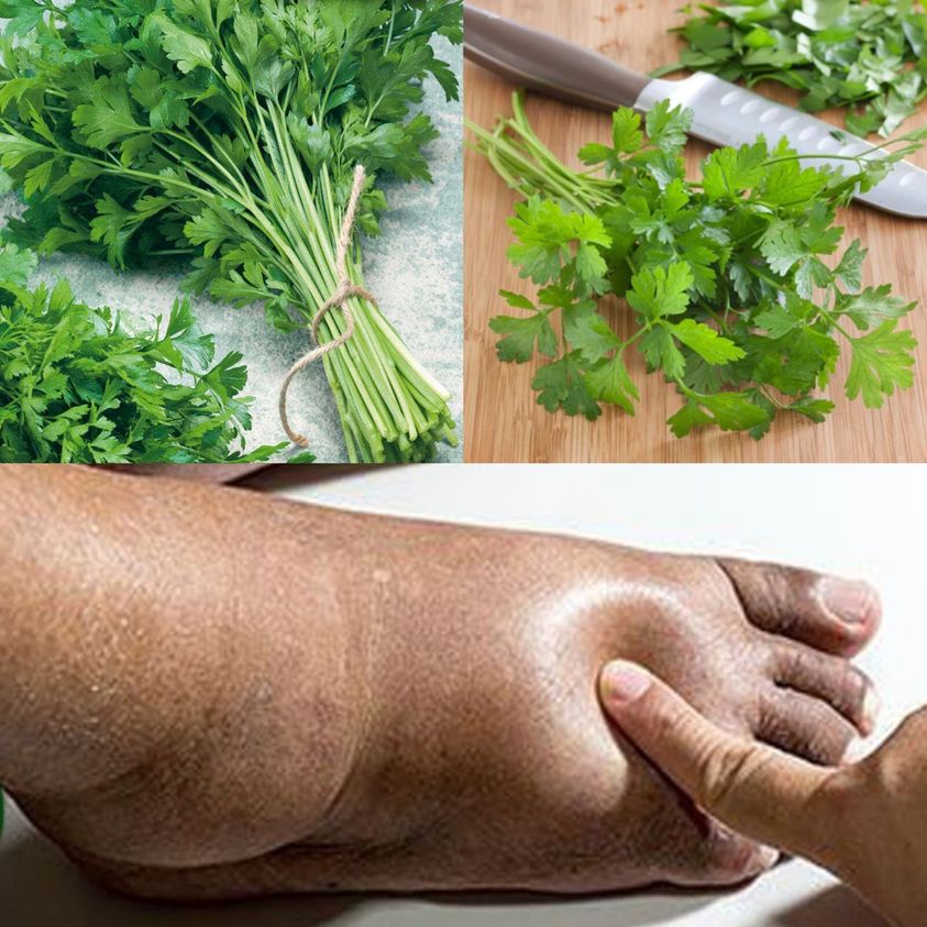 Optimize Fluid Balance Naturally with Parsley