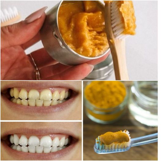 Discover the Dental Benefits of Turmeric: A Natural Wonder for Oral Health