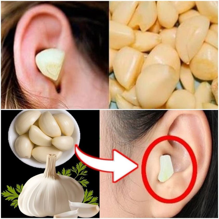 Easing Ear Pain Naturally: Unveiling the Healing Powers of Garlic