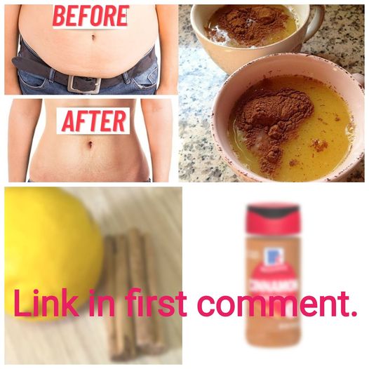 The Power of Cinnamon and Lemon: A Natural Remedy to Help Remove Stubborn Belly Fat