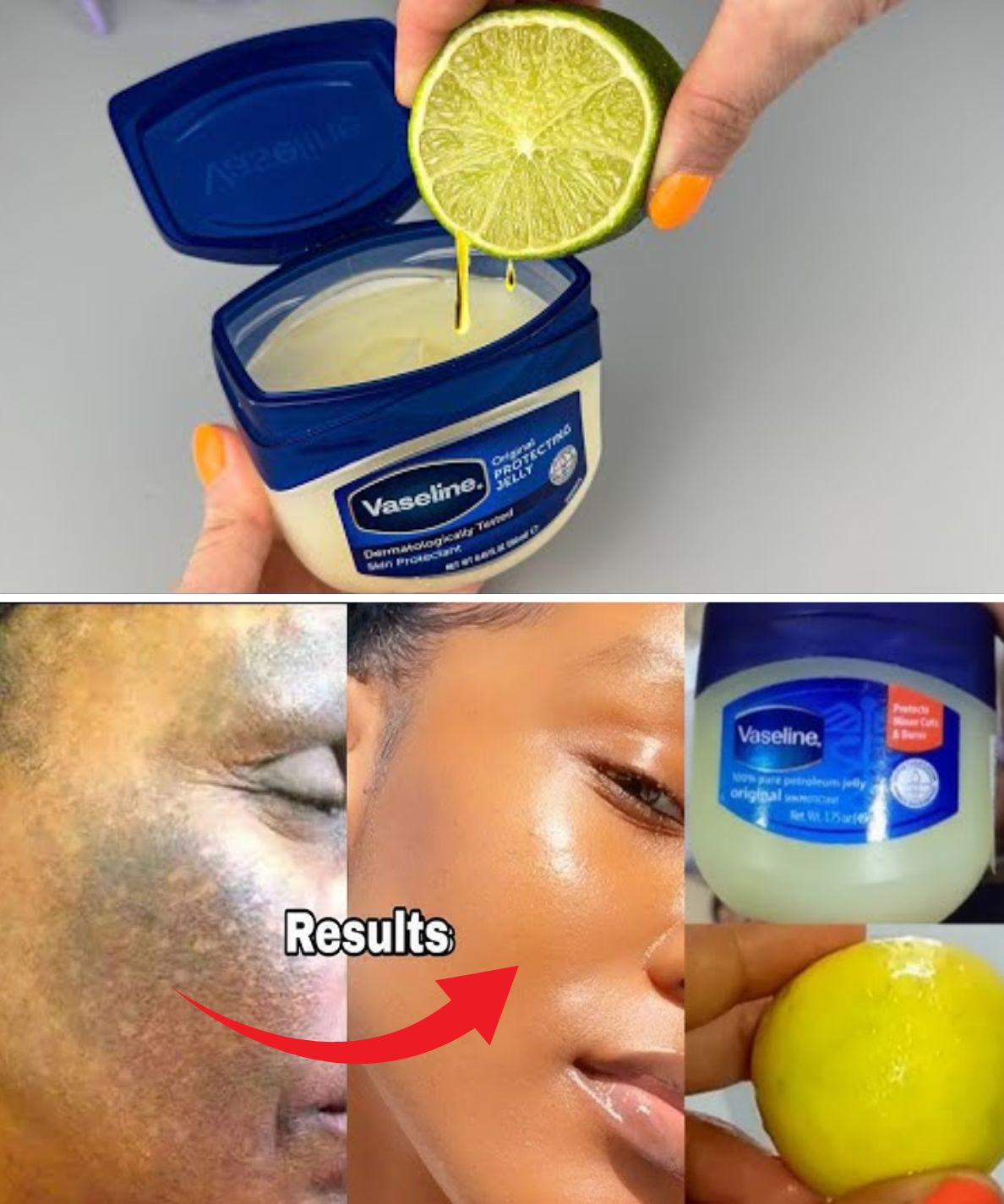 Discover the Astonishing Beauty Benefits of Vaseline and Lemon