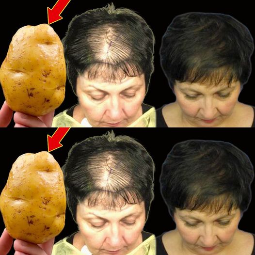 Unlock Rapid Hair Growth with This Powerful Potato Recipe