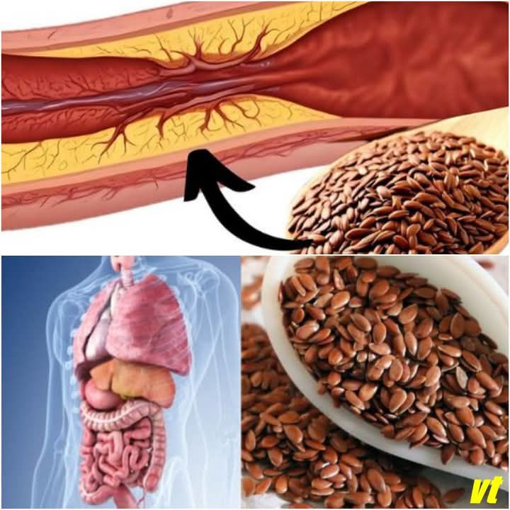 1 Tablespoon A Day: Flaxseed To Prevent Blood Clots, Heart Attacks, And Strokes