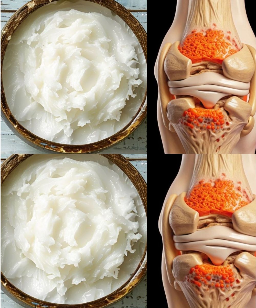 Foods to Rebuild Knee Cartilage: This Is What You Should Eat!