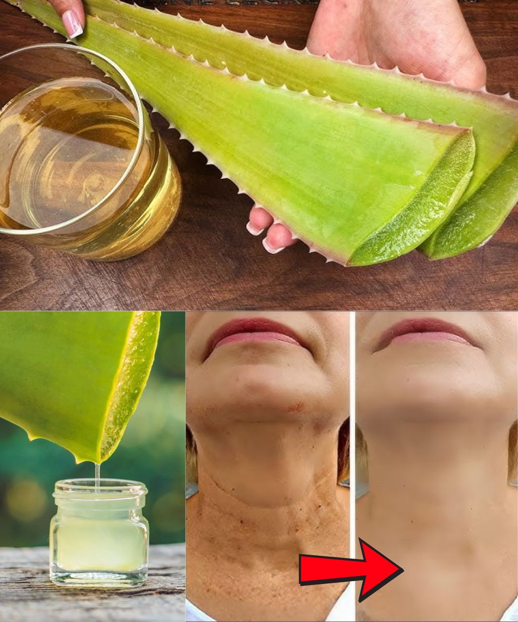 1000 Times Stronger Than Botox! Natural Collagen Aloe Vera! Erases All Wrinkles