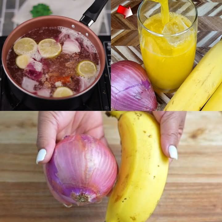 Banana and Onion Remedy for Joint Pain