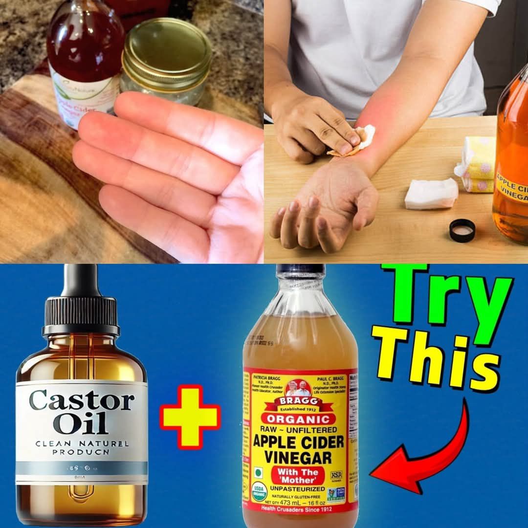 The Amazing Advantages of Adding Apple Cider Vinegar to Castor Oil