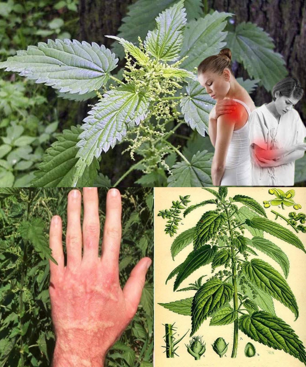 17 Health Remedies Using Stinging Nettle