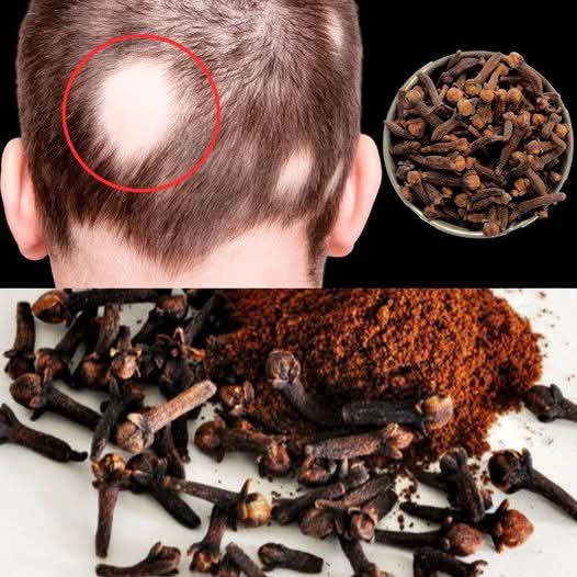 Best Treatment: Clove Oil for Hair