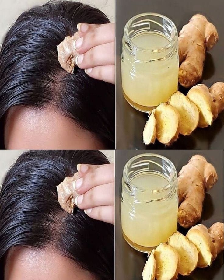 Ginger Remedy for Hair Growth and Hair Loss