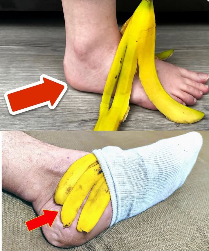 Banana Peel on Your Feet