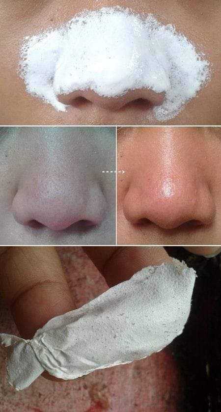 how to make baking soda cream that removes wrinkles skin spots and blackheads