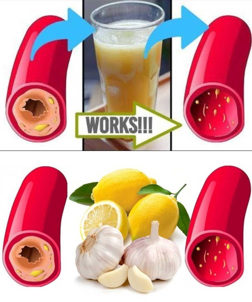 Clear Your Arteries with This Simple Juice – A Natural Remedy for Better Circulation