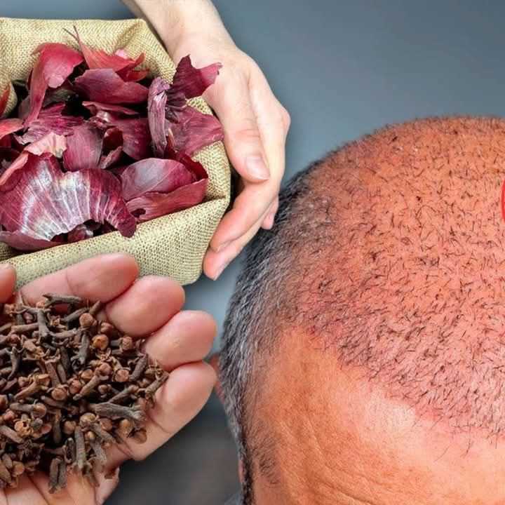 Onion Peel Remedy