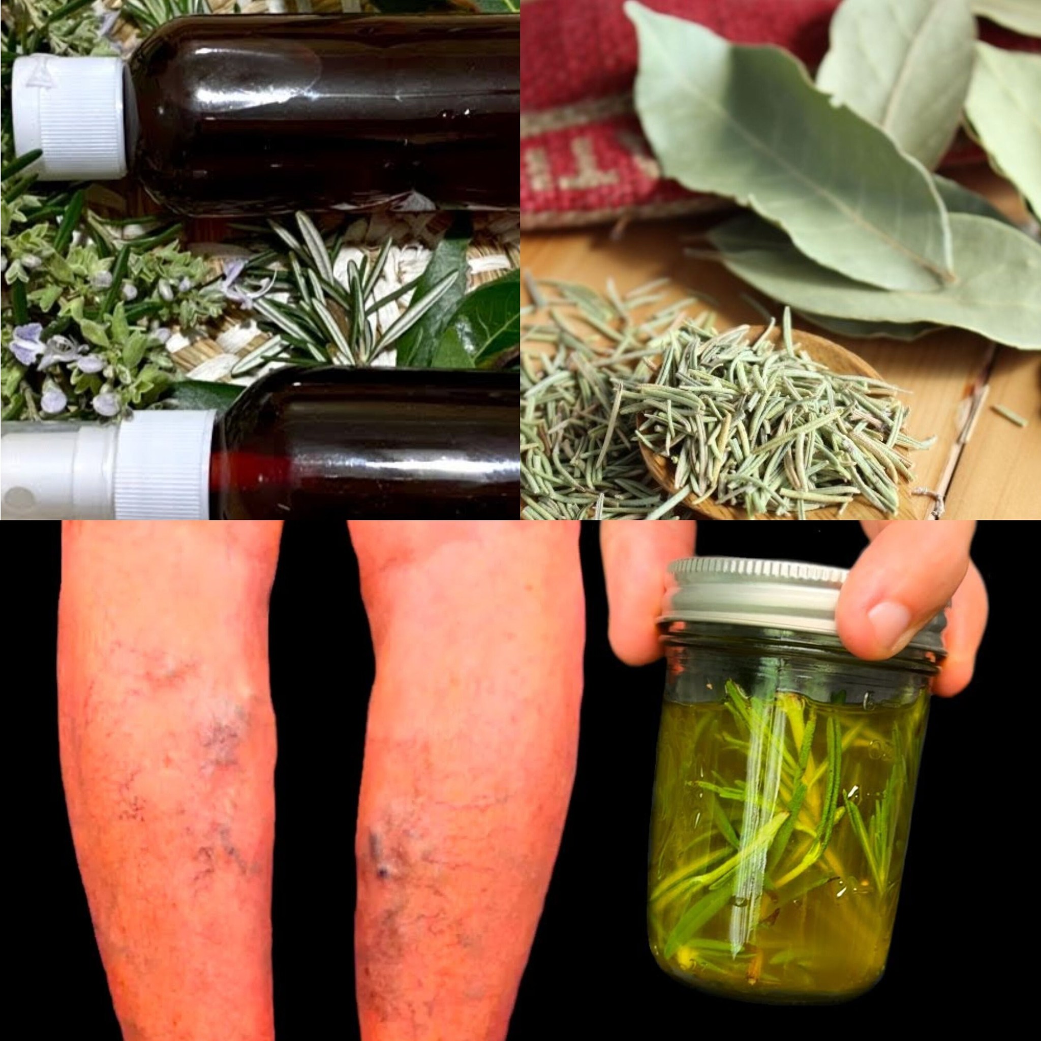 Natural Remedies for Varicose Veins: Rosemary, Ginger, and More