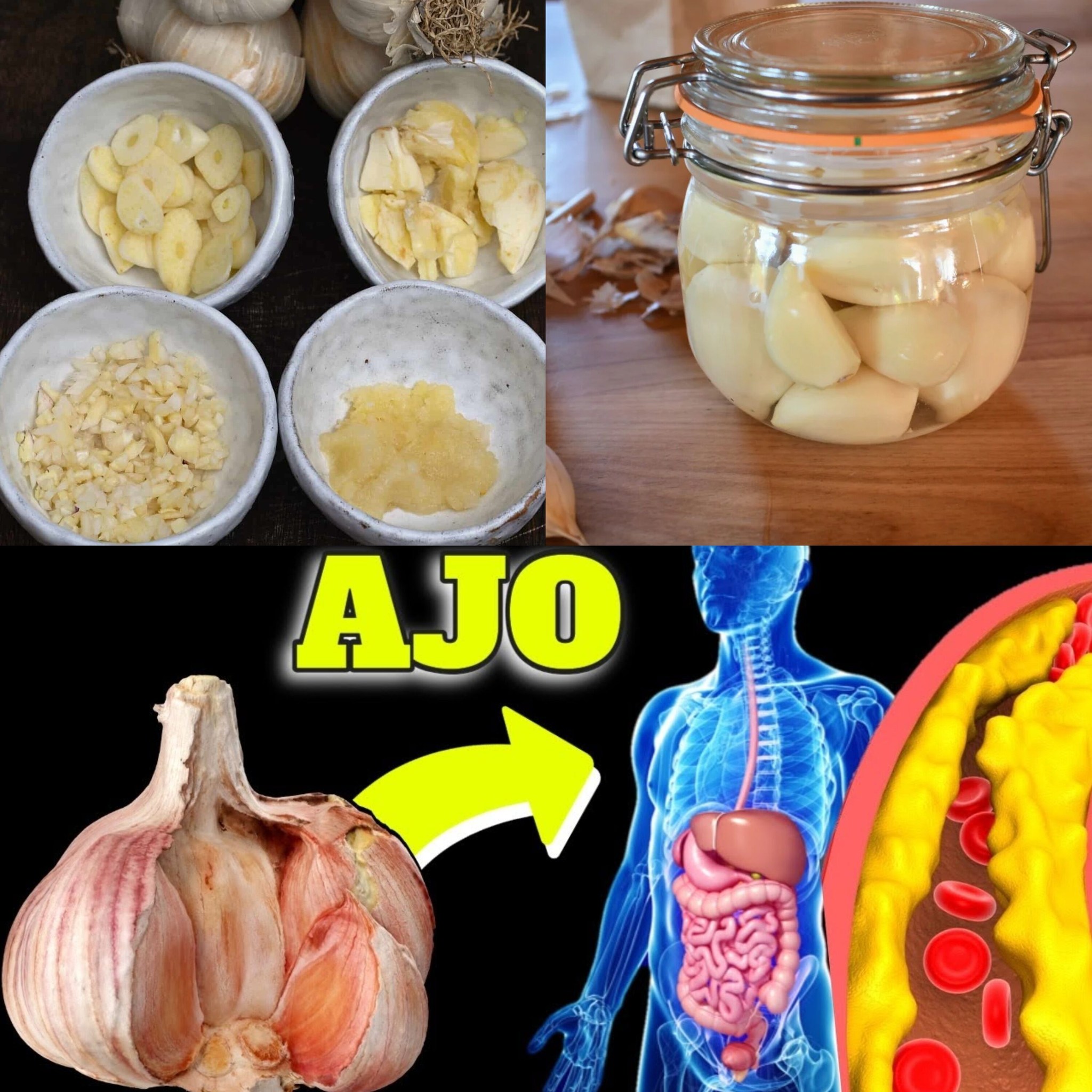 The SUPER BENEFITS of RAW GARLIC: The Best for Circulation, Thrombosis, and Immunity