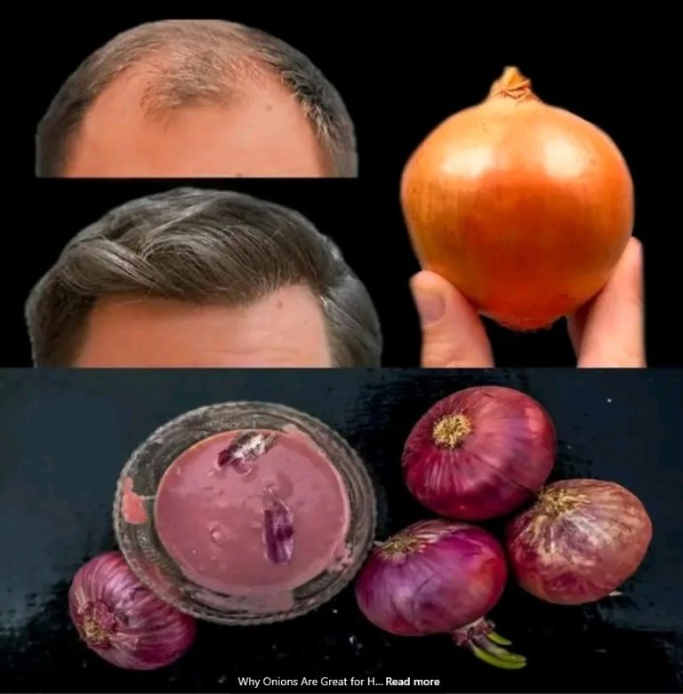 Why Onions Are Great for Hair: Benefits and Uses